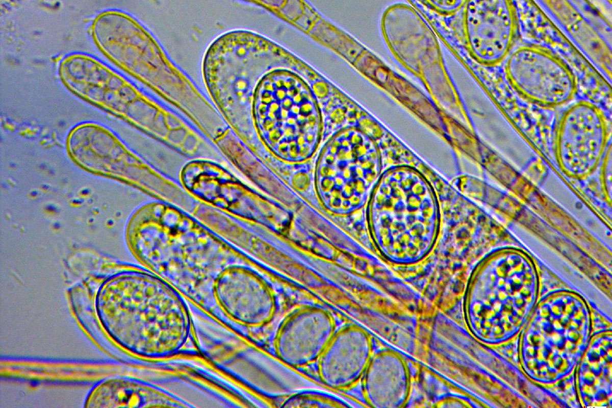 Mikroskopbild: Asci mit Sporen und Paraphysen des Bewimperten Schildborstlings, (c) Chris Engelhardt/NABU-naturgucker.de